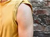 Vaccine mRNA có tiềm năng chống lại bệnh lao